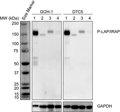 Reciprocal Expression Patterns of Placental Leucine Aminopeptidase/Insulin-Regulated Aminopeptidase and Vasopressin in the Murine Brain